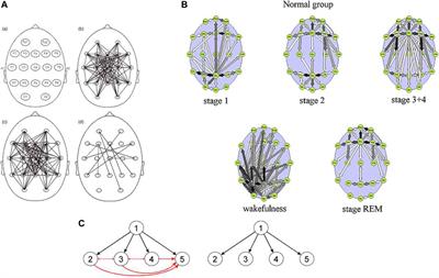 From Coherence to Multivariate Causal Estimators of EEG Connectivity